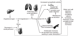 what distinguishes atherosclerosis from arteriosclerosis,symptoms for hypertension, symptoms high blood pressure, what is hypertension symptoms, high blood pressure sign, high blood pressure symptom, high blood pressure sign, high blood pressure symptom, hypertension and symptoms, hypertension signs and symptoms, hypertension symptom, hypertension symptoms , pulmonary hypertension symptoms, hypertension stage 1 symptoms, stage 1 hypertension symptoms, hypertension stage 2 symptoms, endocrine hypertension symptoms, exercise induced hypertension symptoms, outward symptoms of hypertension include, scleroderma pulmonary hypertension symptoms, what is the primary symptom of hypertension quizlet, hypertension differential diagnosis uptodate, nursing diagnosis pulmonary hypertension, pulmonary hypertension nursing diagnosis, pulmonary hypertension diagnosis, nsg diagnosis for hypertension, hypertension nsg diagnosis, nurses diagnosis for hypertension , nursing diagnosis hypertension , nursing diagnosis in hypertension, nursing diagnosis with hypertension, nursing diagnosis of hypertension, hypertension treatment , pulmonary hypertension treatment, treatment for pulmonary hypertension, treatment for hypertension, hypertension treatments, hypertensive crisis treatment, pulmonary hypertension treatments, treatment hypertension, treatment of hypertension, stage 1 hypertension treatment, non pharmacological treatment of hypertension, hypertensive emergency treatment guidelines ppt, newly diagnosed hypertension treatment, which medication is used in the treatment of hypertension quizlet , exercise induced hypertension treatment, hypertension in dialysis pathophysiology and treatment, hypertensive crisis treatment maoi , non pharmacological treatment for hypertension, non pharmacological treatment of hypertension pdf, post nephrectomy hypertension treatment, how can hypertension be prevented brainly, epidemiology and prevention of hypertension, prevention and control of hypertension ppt, prevention of hypertension, how can hypertension be prevented, hypertension prevention, how to prevent hypertension, what is primary prevention of hypertension , how can hypertension be prevented quizlet, ,atherosclerosis symptoms, atherosclerosis of aorta, atherosclerosis, what is atherosclerosis , atherosclerosis vs arteriosclerosis, atherosclerosis symptoms, how to pronounce atherosclerosis, aortic arch atherosclerosis, multiple sclerosis and atherosclerosis, cerebral atherosclerosis icd 10, atherosclerosis pronunciation, what distinguishes atherosclerosis from arteriosclerosis, atherosclerosis pathology ppt, morphology of atherosclerosis, atherosclerosis pathophysiology ppt, hypertension, high blood pressure symptoms, high bp symptoms, high blood pressure , bp bp, etiology of hypertension, etiology of hypertension blood pressure , arterial hypertension etiology, pathophysiology of hypertension ppt, hypertension pathophysiology, pathophysiology of hypertension, pathophysiology of hypertension slideshare, pathophysiology of hypertension pdf, pregnancy induced hypertension pathophysiology, pulmonary hypertension pathophysiology, pathophysiology of hypertension in flow chart pathophysiology of hypertension flowchart, pathophysiology of htn, pathophysiology of hypertension , pathology of hypertension, Chronic renal failure, Primary hyperaldosteronism Stress, Sleep Apnea, Pheochromocytoma, Preeclampsia, Aortic coarctation,