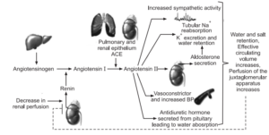 what distinguishes atherosclerosis from arteriosclerosis, atherosclerosis symptoms, atherosclerosis of aorta, atherosclerosis, what is atherosclerosis , atherosclerosis vs arteriosclerosis, atherosclerosis symptoms, how to pronounce atherosclerosis, aortic arch atherosclerosis, multiple sclerosis and atherosclerosis, cerebral atherosclerosis icd 10, atherosclerosis pronunciation, what distinguishes atherosclerosis from arteriosclerosis, atherosclerosis pathology ppt, morphology of atherosclerosis, atherosclerosis pathophysiology ppt, hypertension, high blood pressure symptoms, high bp symptoms, high blood pressure , bp bp, etiology of hypertension, etiology of hypertension blood pressure , arterial hypertension etiology, pathophysiology of hypertension ppt, hypertension pathophysiology, pathophysiology of hypertension, pathophysiology of hypertension slideshare, pathophysiology of hypertension pdf, pregnancy induced hypertension pathophysiology, pulmonary hypertension pathophysiology, pathophysiology of hypertension in flow chart pathophysiology of hypertension flowchart, pathophysiology of htn, pathophysiology of hypertension , pathology of hypertension, Chronic renal failure, Primary hyperaldosteronism Stress, Sleep Apnea, Pheochromocytoma, Preeclampsia, Aortic coarctation,