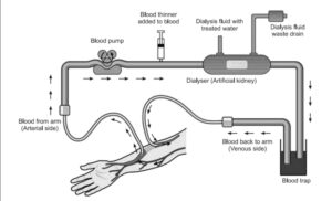 cronic renal failure, what is chronic renal failure, chrinic renal failure, chronic renal failure is a condition that, chronic renal failure definition, what is chronic renal failure, why does chronic renal failure cause proteinuria, which is the leading cause of chronic renal failure quizlet, which of the following does not describe chronic renal failure, what can cause chronic renal failure, chronic renal failure, chronic renal failure diet, chronic renal failure icd 10, icd 10 acute on chronic renal failure, acute on chronic renal failure icd 10, chronic renal failure is a condition that , diet for chronic renal failure, icd 10 code for chronic renal failure, acute on chronic renal failure, chronic renal failure symptoms, chronic renal failure is a condition that quizlet , chronic renal failure is a condition that emt quizlet , which is the leading cause of chronic renal failure quizlet, spontaneous hypoglycemia in chronic renal failure, abbreviation for chronic renal failure , chronic renal failure images , chronic renal failure quizlet, hesi case study chronic renal failure, psychological aspects in chronic renal failure, chronic renal failure nursing diagnosis , nursing diagnosis chronic renal failure, nursing diagnosis for chronic renal failure , dietary teaching for a patient with chronic renal failure, homemade diet for dogs with chronic renal failure, chronic renal failure in cats treatment, difference between acute and chronic renal failure , difference between acute renal failure and chronic renal failure, acute kidney injury vs chronic renal failure, acute vs chronic renal failure, cronic kidney failure, chronic kidney disease and kidney failure, kidney failure chronic, chronic kidney disease ckd, chronic kidney diseases, is chronic kidney disease the same as kidney failure, what is chronic kidney failure, chronic kidney failure, chronic kidney failure medications, chronic kidney failure symptoms, acute on chronic kidney failure icd 10, chronic kidney failure icd 10, chronic kidney failure stage 3 , chronic kidney failure.,