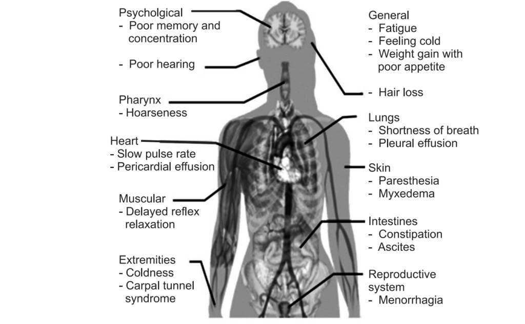 thyroid-disease-what-is-hypothyroidism-hyperthyroidism-symptoms