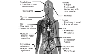 THYROID DISEASES ,thyroid eye disease,thyroid disease,thyroid disease symptoms,thyroid eye disease symptoms,symptoms of thyroid disease,what is thyroid disease,what is thyroid eye disease,what does thyroid eye disease look like,what causes thyroid eye disease,,what are the symptoms of thyroid eye disease,disease thyroid,diseases of thyroid gland disorder of thyroid, thuroid disease, thyroid disorder, thyroid gland disorders, thyroid gland diseases, thyroid conditions, about thyroid disease, how to treat thyroid disease naturally, autoimmune thyroid disease, thyroid disease icd 10 , thyroid gland disease, types of thyroid disease, thyroid disease in hindi , thyroid disease test , thyroid eye disease, thyroid disease ppt, thyroid eye disease ppt, diffuse thyroid disease, does thyroid disease cause hives, family history of thyroid disease icd 10, high triglycerides and thyroid disease , ophthalmologist specializing in thyroid eye disease near me , petechiae thyroid disease, thyroid eye disease icd 10 , what is thyroid disease in hindi, hypothyroidism test name , hypothyroidism test , hypothyroidism blood test, hypothyroid diet chart indian, thyroid test for hypothyroidism, hypothyroidism tsh, vegetarian diet for hypothyroidism, hypothyroidism test cost ,hypothyroidism and weight loss , 7 day hypothyroid diet plan india , hypothyroidism, hypothyroidism symptoms, hypothyroidism diet , hypothyroidism treatment , hypothyroidism causes, hypothyroidism icd 10 , hypothyroidism tsh levels, subclinical hypothyroidism, what is hypothyroidism , difference between hypothyroidism and hyperthyroidism , hypothyroidism kya hai , hypothyroidism meaning in hindi, hypothyroidism meaning in tamil, hypothyroidism meaning in marathi , hypothyroidism symptoms in tamil, acupressure points for hypothyroidism, hypothyroidism in pregnancy ppt , hypothyroidism in tamil, losing weight with hypothyroidism success stories, hyperthyroidism, hyperthyroidism symptoms, hyperthyroidism treatment, hyperthyroidism causes, hyperthyroidism tsh levels, what is hyperthyroidism, is hyperthyroidism curable, what causes hyperthyroidism, can hyperthyroidism be cured, is hyperthyroidism dangerous, symptoms of increased thyroid hormone, excess of thyroid, hyperthyroid disease, hyperthyroidism causes, most common cause of hyperthyroidism, hyperthyroidism diet , hyperthyroidism symptoms in females ,hyperthyroidism icd 10, what is hyperthyroidism, hyperthyroidism, types of hyperthyroidism , sbl homeopathy medicine for hyperthyroidism, apathetic hyperthyroidism,hyperthyroid kya hai , hyperthyroidism and hypothyroidism ppt, hyperthyroidism meaning in hindi, hyperthyroidism in pregnancy ppt,